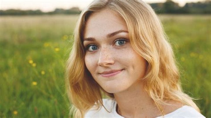 Are dimples genetic?