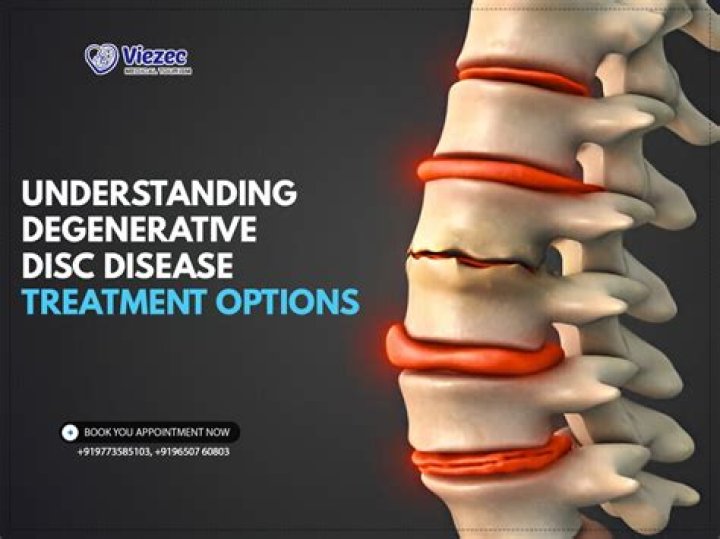 Can prednisone cause degenerative disc disease?