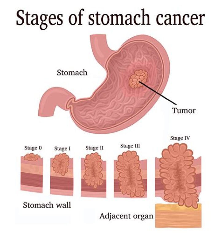 Can sucking in your stomach make it flatter?