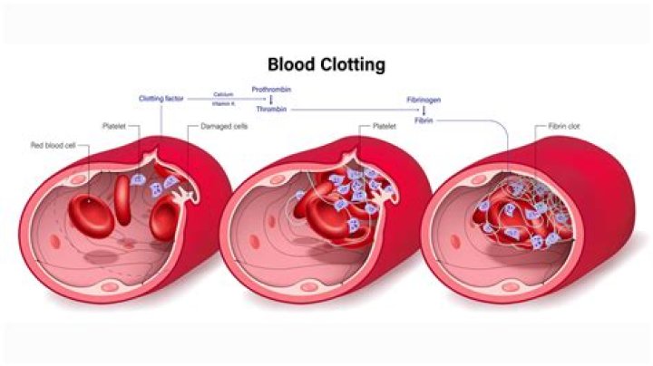 How does the body get rid of blood clots?