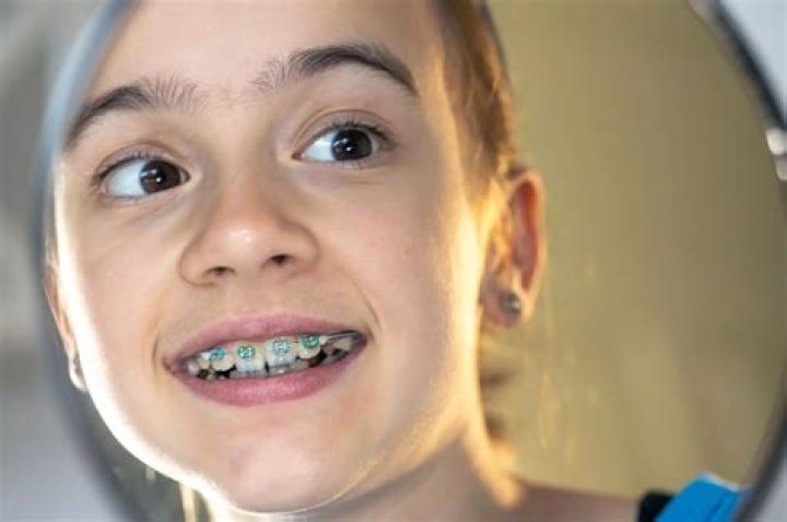 Is it OK to sleep with wax on your braces?