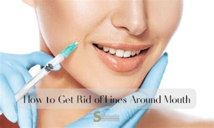 What is best treatment for lines around the mouth?