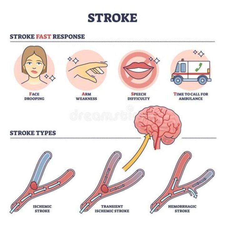 What time do most strokes happen?